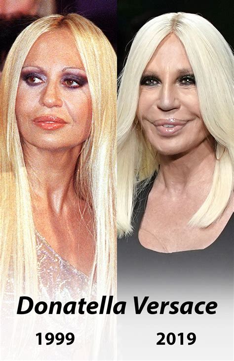 versace donatella früher